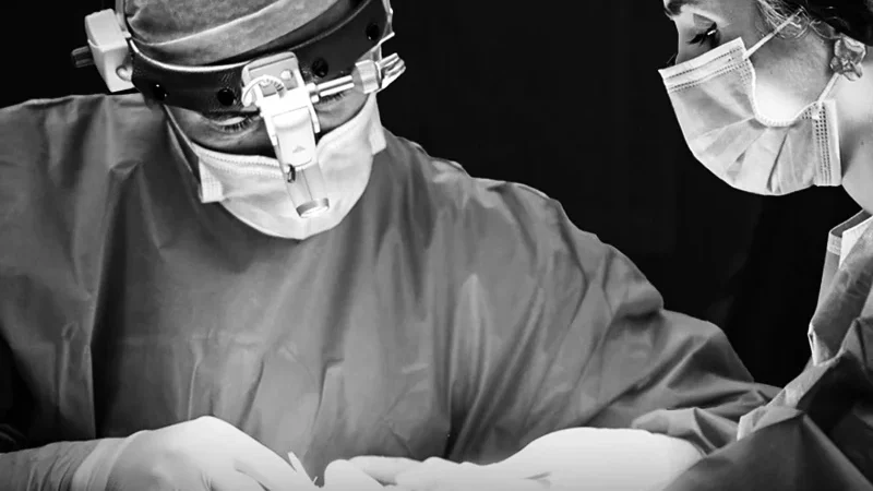 face-lift-deep-plane-2